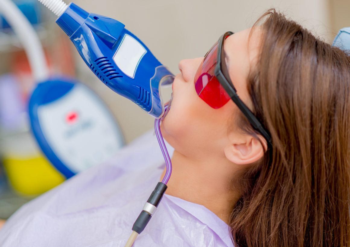 laser-teeth-whitening-2021-08-26-22-28-14-utc Lazerle Diş Beyazlatma