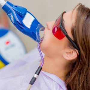 laser-teeth-whitening-2021-08-26-22-28-14-utc Lazerle Diş Beyazlatma