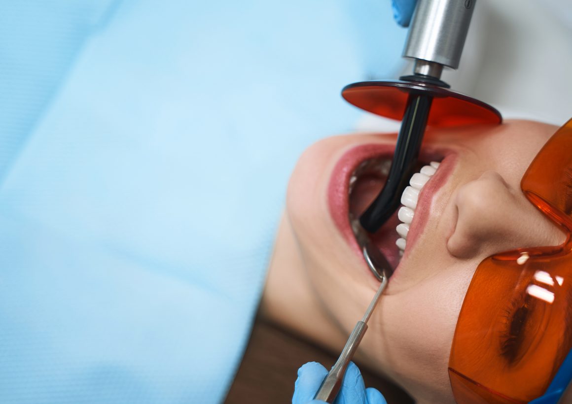 woman-is-getting-root-canal-stock-photo-2021-09-03-15-38-29-utc Kanal Tedavisi