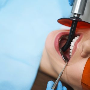 woman-is-getting-root-canal-stock-photo-2021-09-03-15-38-29-utc Kanal Tedavisi